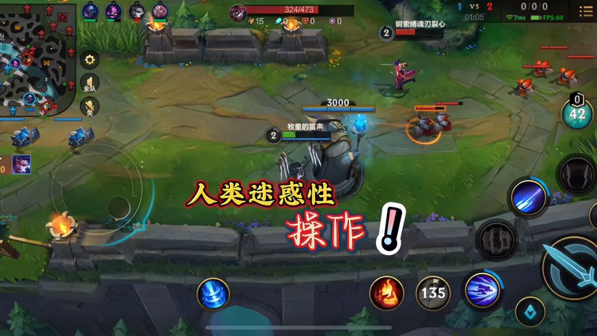 lol手游：你们会不会也有这离谱的操作？玩完手机都不用想要了