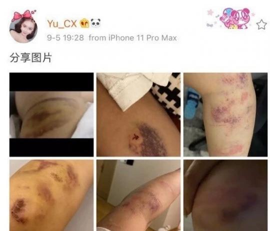 被父亲当成摇钱树压榨?死亡宣告微博发文,揭露暴力倾向成因